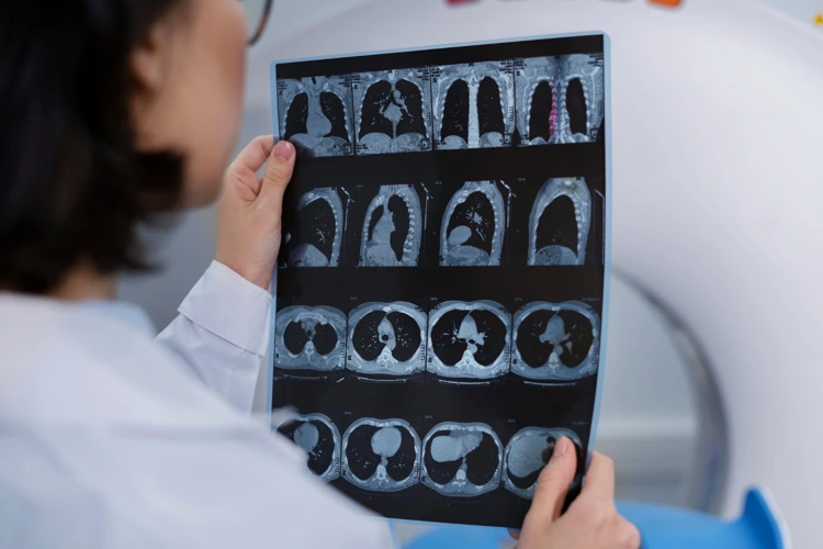 Doctor examining imaging of patient from PET CT scan results.