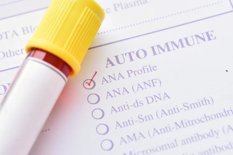 Antinuclear antibody (ANA) test form with a blood sample.