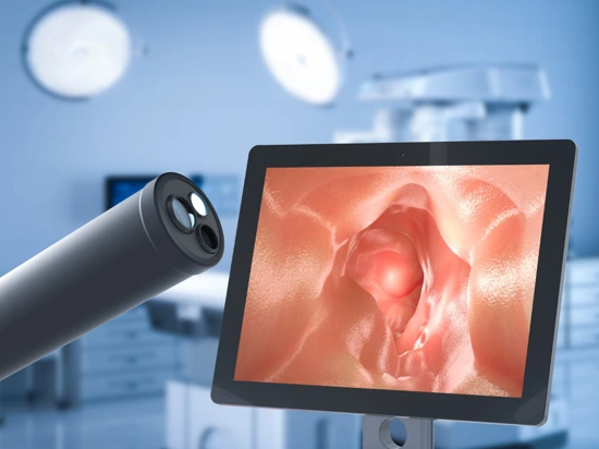 Colonoscopy procedure with endoscope and monitor displaying patient's intestine.