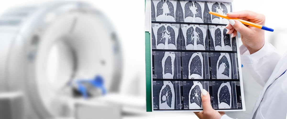 Radiologist analyzing tomography scan results of patient's lungs.