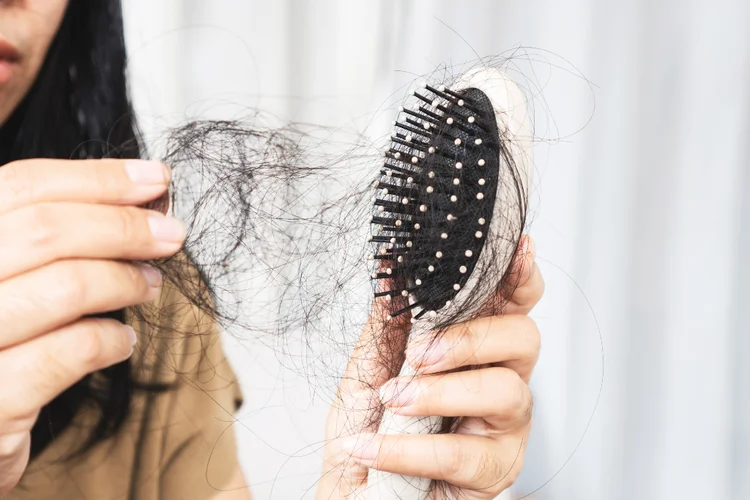 Woman holding hairbrush with loose hair showing signs of thinning and shedding.