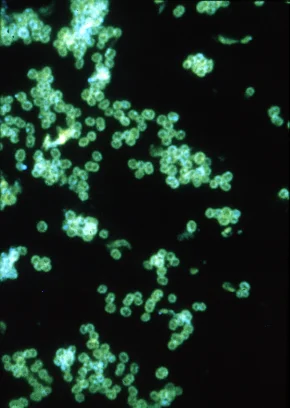 Fluorescent test pattern showing antinuclear antibodies.