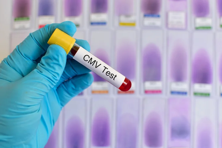 Gloved hand holding blood sample labelled CMV test, showing PCR diagnosis for CMV in Singapore.