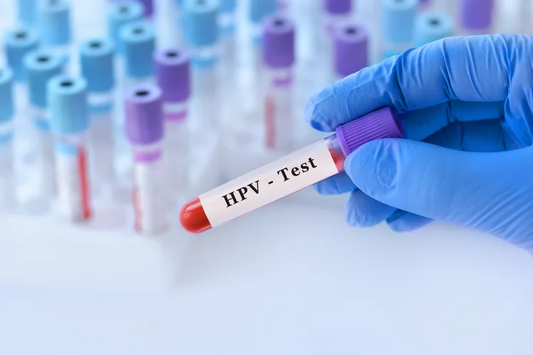 Gloved hand holding a blood sample labeled 'HPV Test', with test tubes in the background, depicting HPV testing for cervical cancer.