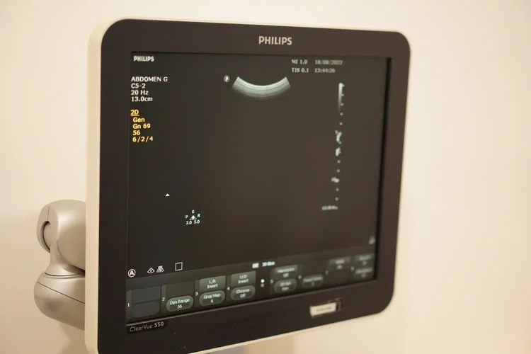 Philips ultrasound monitor displaying prostate imaging data at ATA Medical.