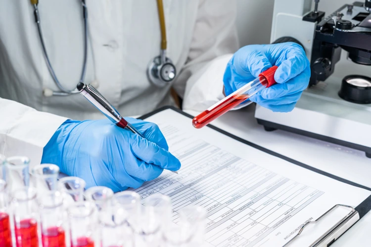 Doctor taking down notes from patient's blood sample for testosterone testing.