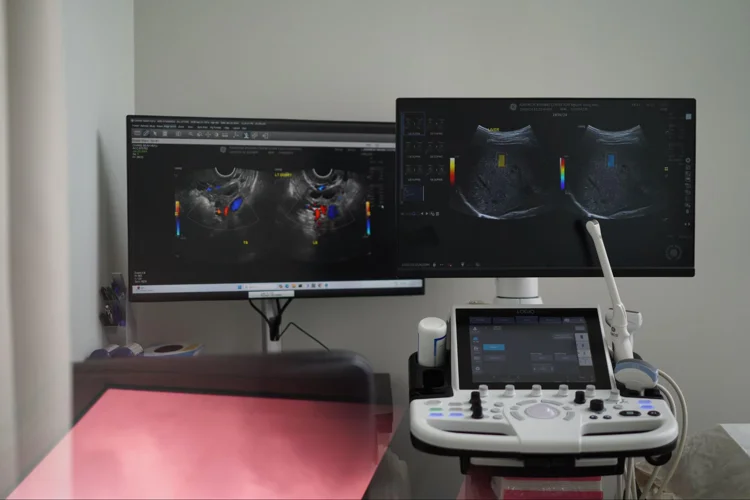 Ultrasound scan machine at clinic with 2 monitors to view the imaging.