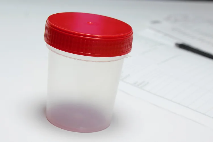 Sterile urine container used for health screening and diagnostic testing in Singapore.